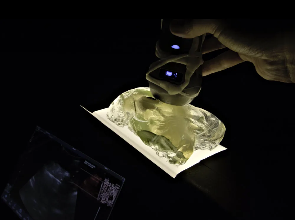 Ultrasound Probe as Tool for Tangible Sound Performance Using Physically Sculpted Phantoms